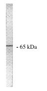 Legend: Exalpha’s sheep anti PP 2A/A antibody western blot of total rat brain homogenate.
